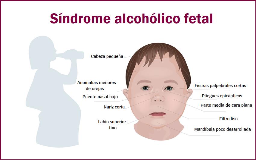 Alteraciones fenotípicas asociadas al síndrome alcohólico fetal